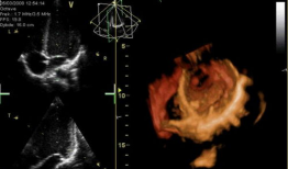 心脏跳动的视频,揭秘心脏跳动的奥秘